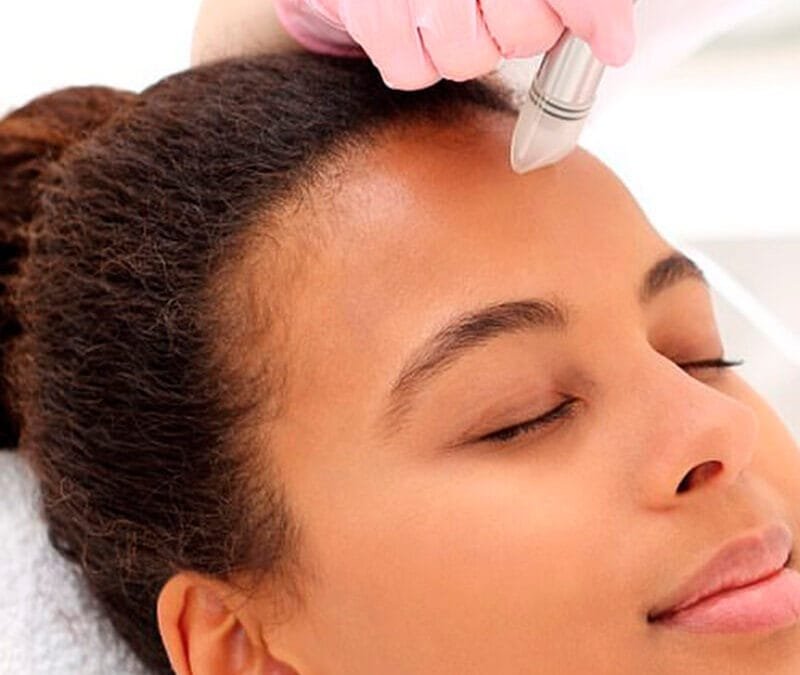 Microneedling in Nairobi
