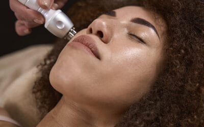 Dermabrasion in Nairobi Kenya