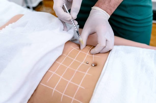 Cellulite Treatment in Nairobi, Kenya - Mesotherapy