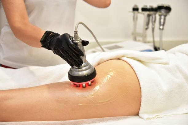 Cellulite Treatment in Nairobi, Kenya - RF Therapy