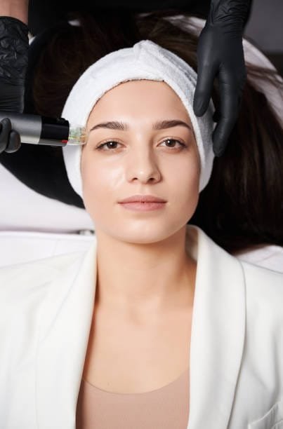 laser skin tightening